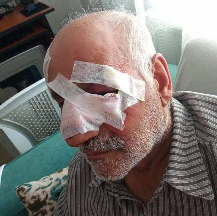 Köpek saldırısında yaralandı, günlerdir yaşam savaşı veriyor