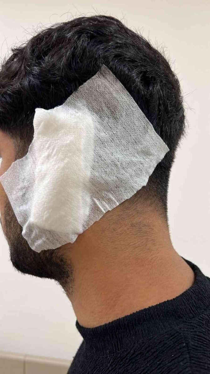 Akıl almaz kavga kamerada: Alçılı kolla ve falçatayla saldırıp, kulağından ısırdı