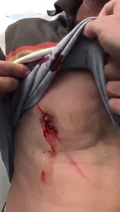 Falçatayla yaralanan sürücü: Niyeti öldürmekti