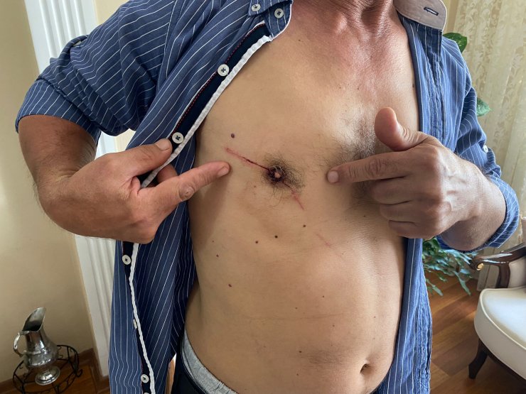 Falçatayla yaralanan sürücü: Niyeti öldürmekti