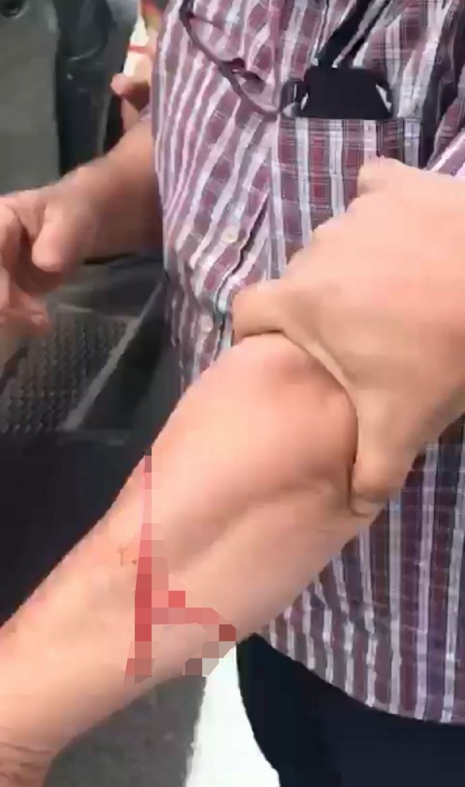 Trafikte tartıştığı 3 kişiyi falçatayla yaraladı