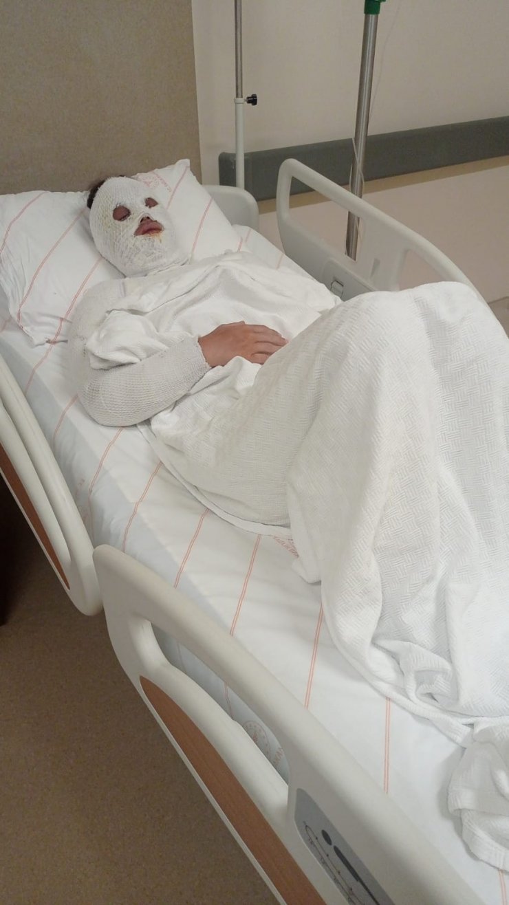 Eski nişanlısının yüzüne kimyasal madde fırlatmıştı; 1 gün önce keşif yapmış