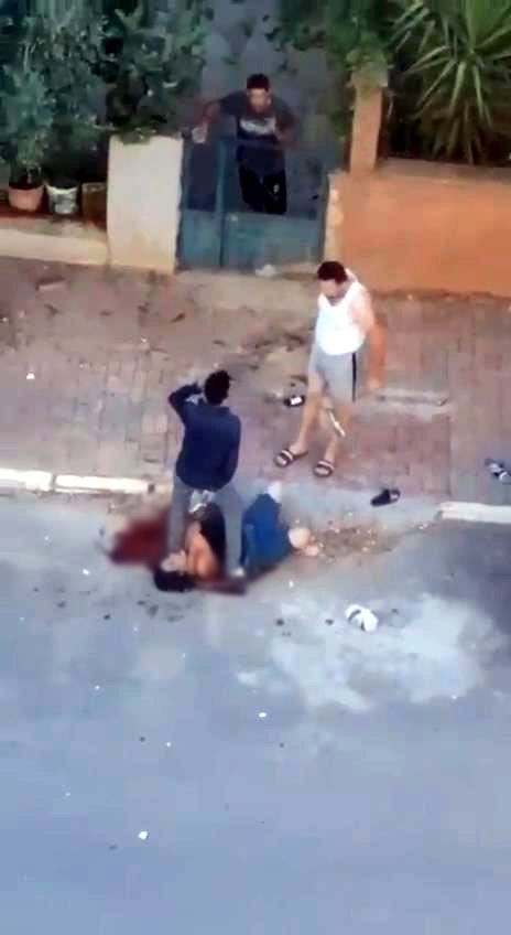 Sevgilisinin boğazını bıçakla kesti, yanına kimseyi yaklaştırmadı