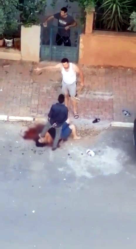 Sevgilisinin boğazını bıçakla kesti, yanına kimseyi yaklaştırmadı