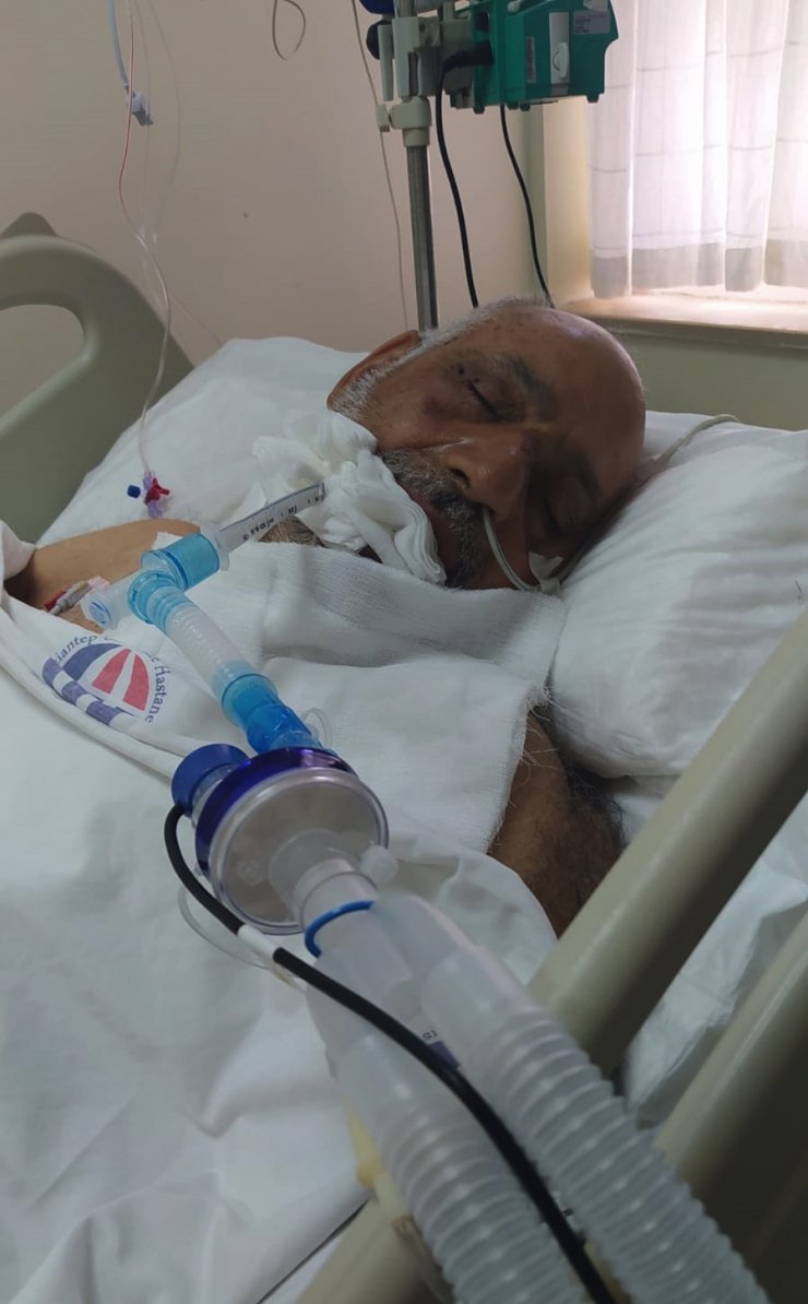 Köpeklerin saldırısına uğramıştı; 54 günlük yaşam mücadelesini kaybetti