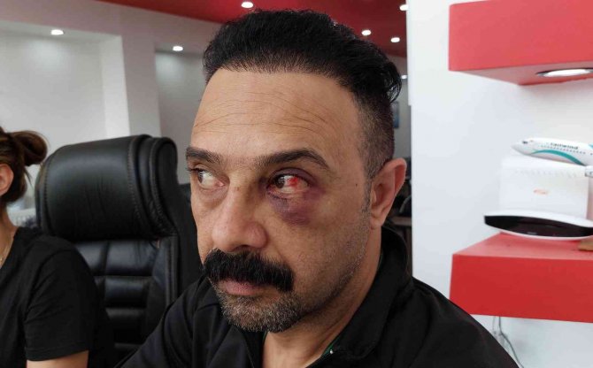 Iraklı şahsa iş yerinde yumruklu saldırı