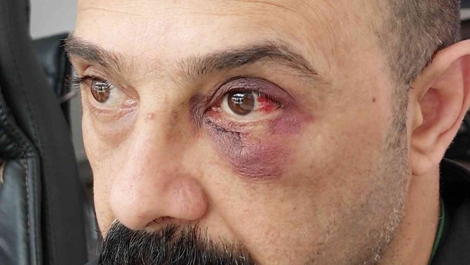 Iraklı şahsa iş yerinde yumruklu saldırı