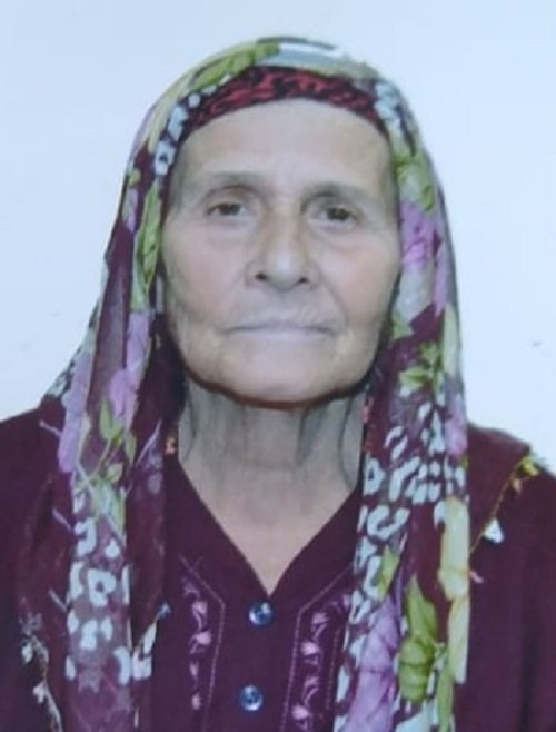 Yangından eşyalarını kurtarmaya çalışmıştı; gözlerinde iltihap oluştu