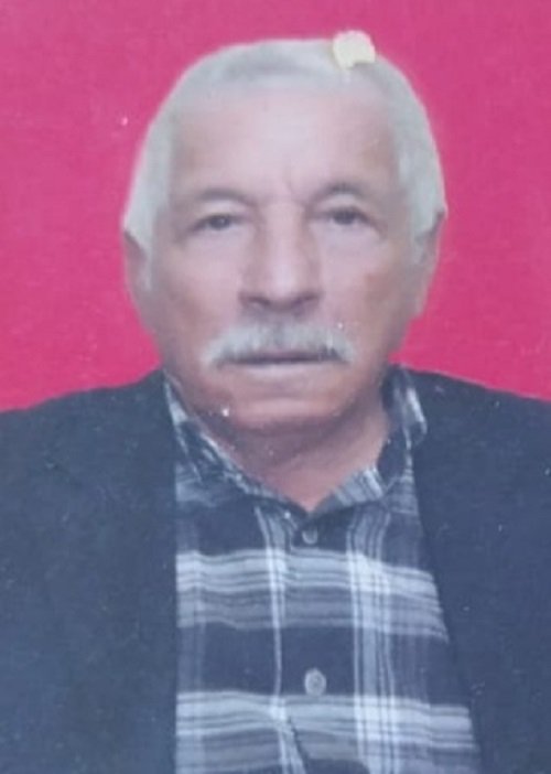 Yangından eşyalarını kurtarmaya çalışmıştı; gözlerinde iltihap oluştu