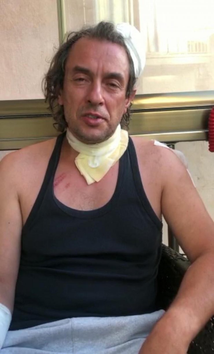 Alkollü yolcu taksi şoförünü ısırdı, darbetti, aracına binip kaza yaptı