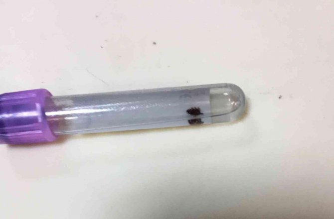 Konya'da vücuduna yapışan kene acil serviste çıkarıldı