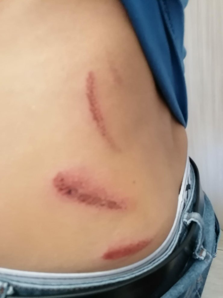 Manisa'daki 'yol verme' kavgasına 8 tutuklama