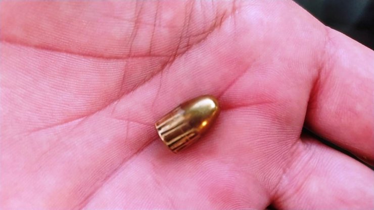 Evinin bahçesinde otururken yorgun mermi ile yaralandı