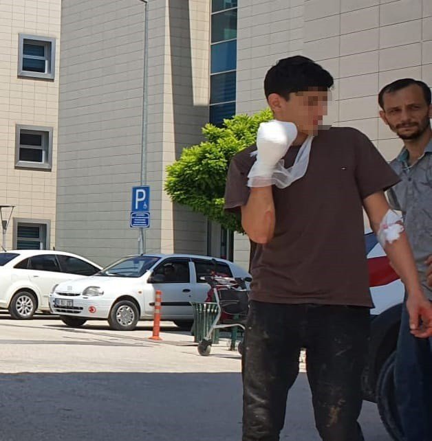 Elini kıyma makinesine kaptırdı