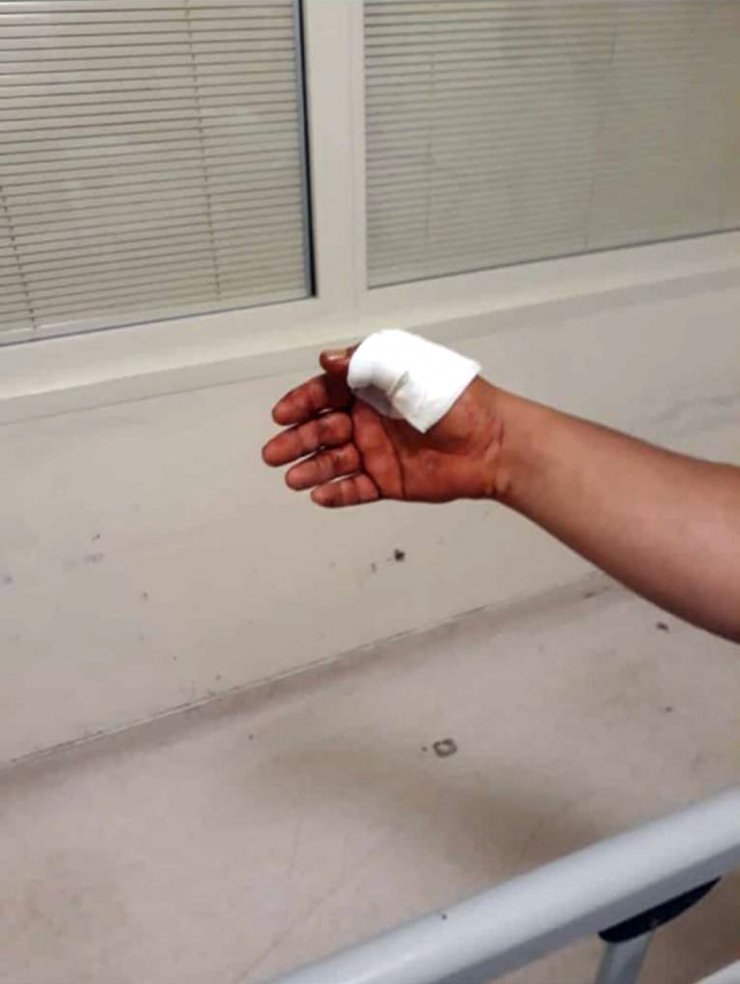 Otomobilini park ederken bıçaklı saldırıya uğradı