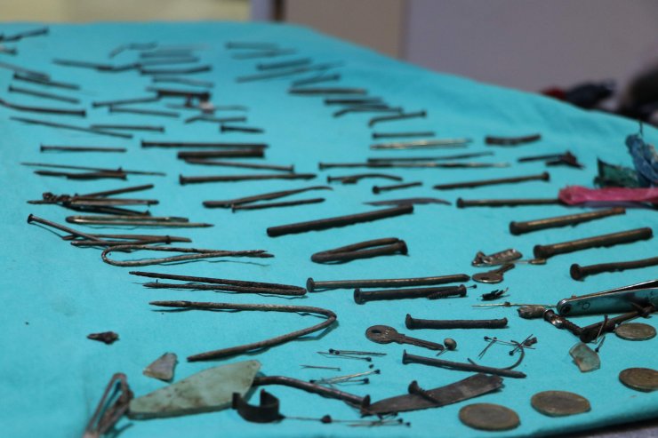 Midesinden 158 parça metal çıkarıldı! Çivi, bıçak, tırnak makası...