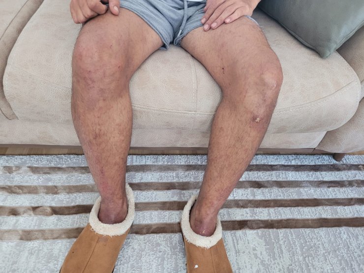 Ormanda 8 günlük yaşam mücadelesini anlattı