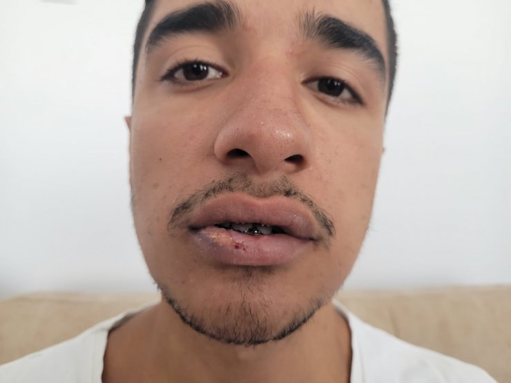 Ormanda 8 günlük yaşam mücadelesini anlattı