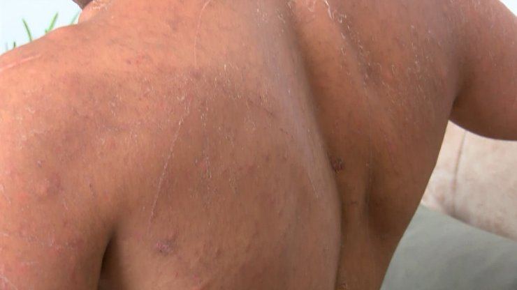 Ormanda 8 günlük yaşam mücadelesini anlattı