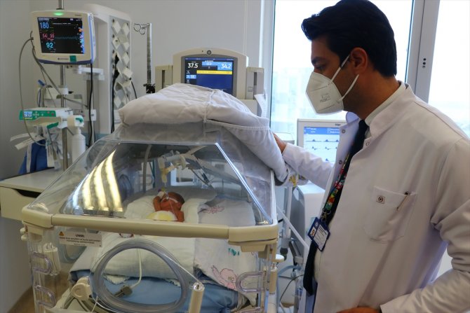 Tekirdağ'da 23 haftalık doğan bebeğe kök hücre nakli yapıldı