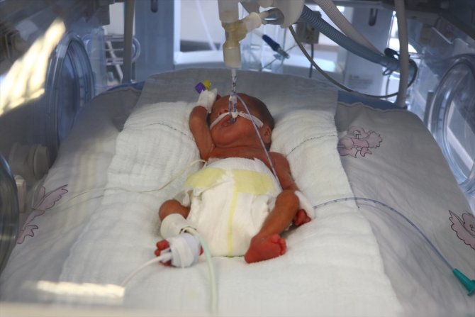 Tekirdağ'da 23 haftalık doğan bebeğe kök hücre nakli yapıldı