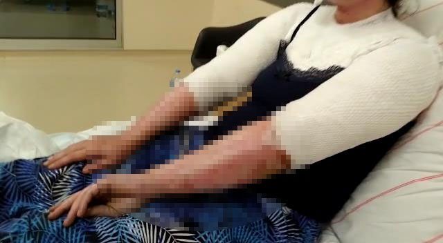 Kimyasallı saldırıya uğrayan Merve: Yüzüme attığı sıvı, kapının boyasını dahi eritmiş