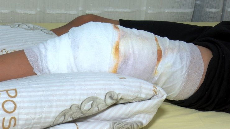 Bahçelievler'de parkta oynayan çocuğa pitbull saldırdı 