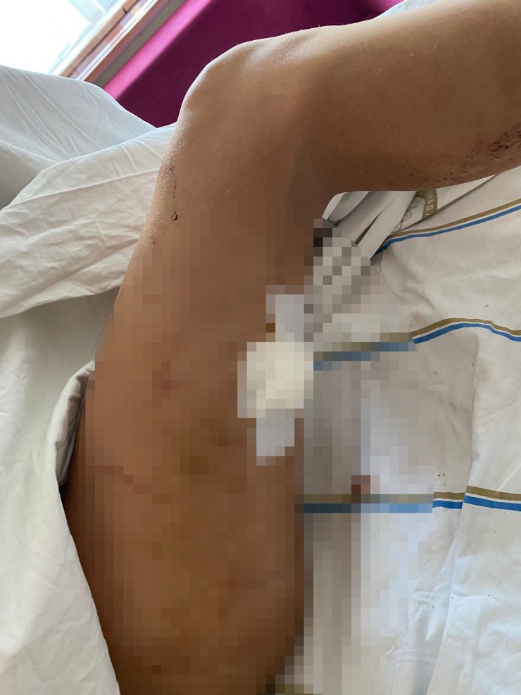 Doktor, sevgilisini dövüp 5 yerinden bıçakladı