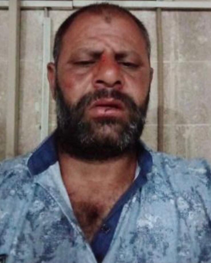 Ambulans şoförünün burnunu kıran motosikletli tutuklandı