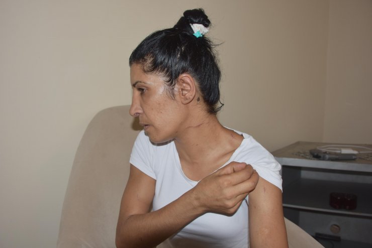 Eşinin rehin aldığı Gülşen: Bir kadın cinayeti daha yaşanmasın