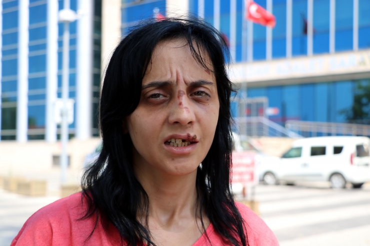 Sokakta tanımadığı kadına yumruk atıp, dişlerini kırdı