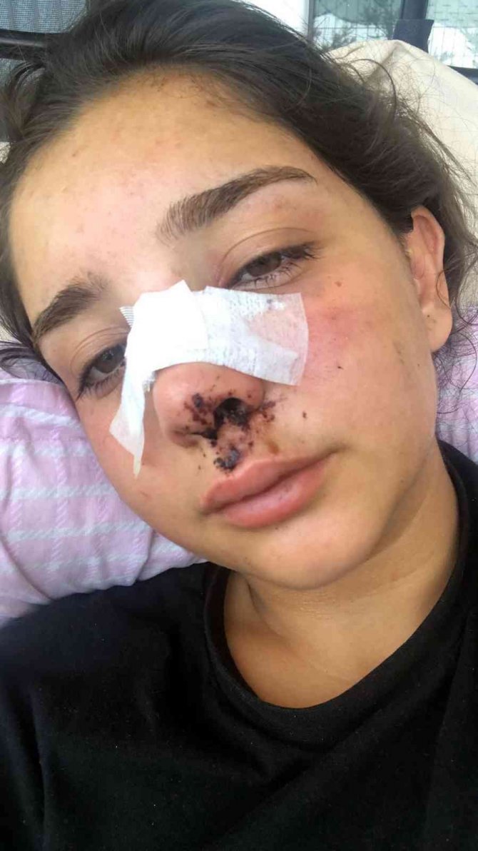 Bisikletli genç kıza çarptıktan sonra kaçtı, iki arkadaşa dehşeti yaşattı