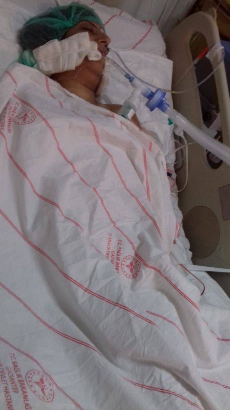 Pompalı tüfekle vurulan Suriyeli Hamide, 12 gün sonra öldü