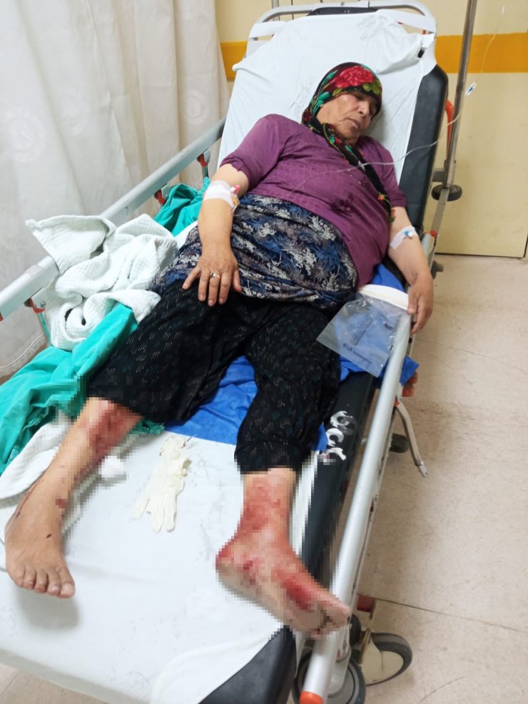 Pompalı tüfekle vurulan Suriyeli Hamide, 12 gün sonra öldü