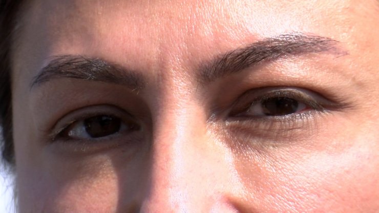 7 yıldır süren göz altı torbası ameliyatı davası