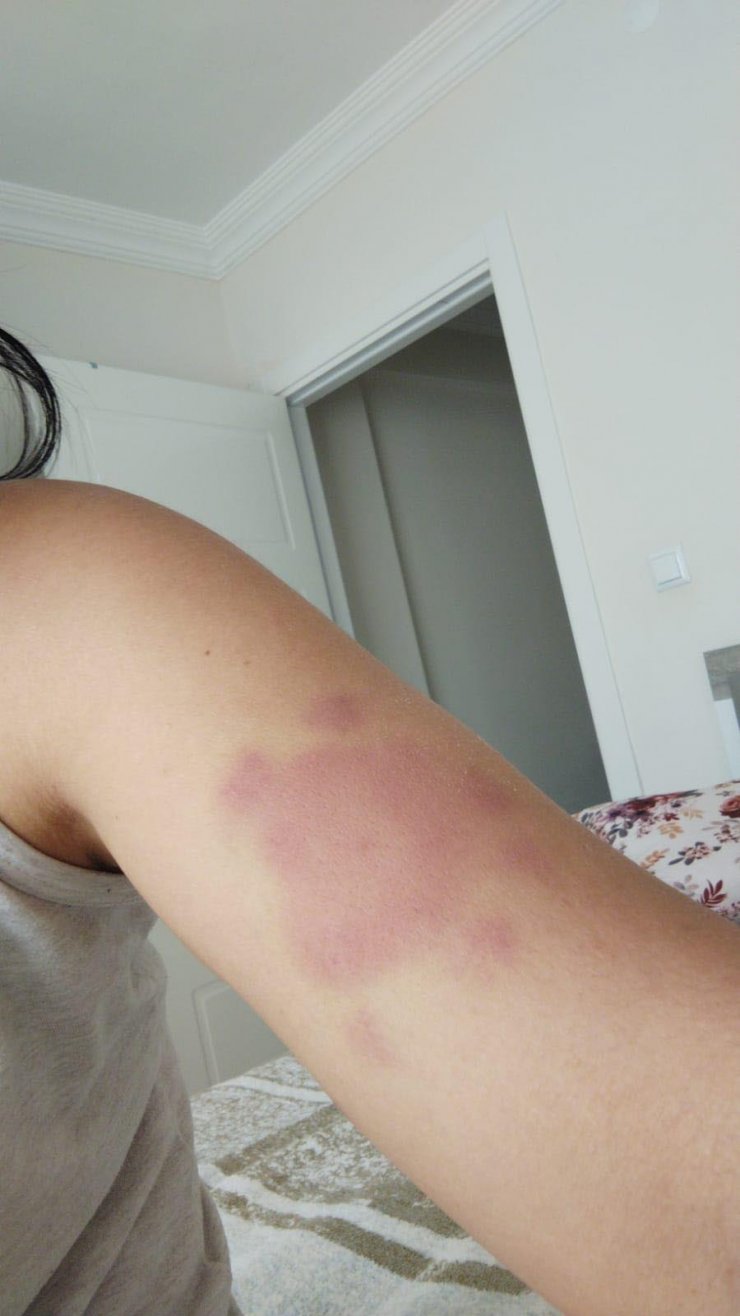 Tuğba'yı tehdit edip, döven eski koca tutuklandı