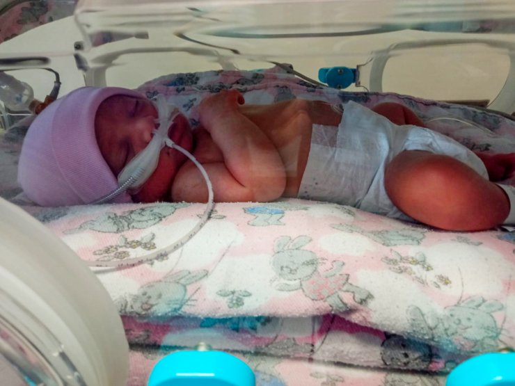 Kumsal bebek büyüdükçe kalbindeki delik de büyüyor