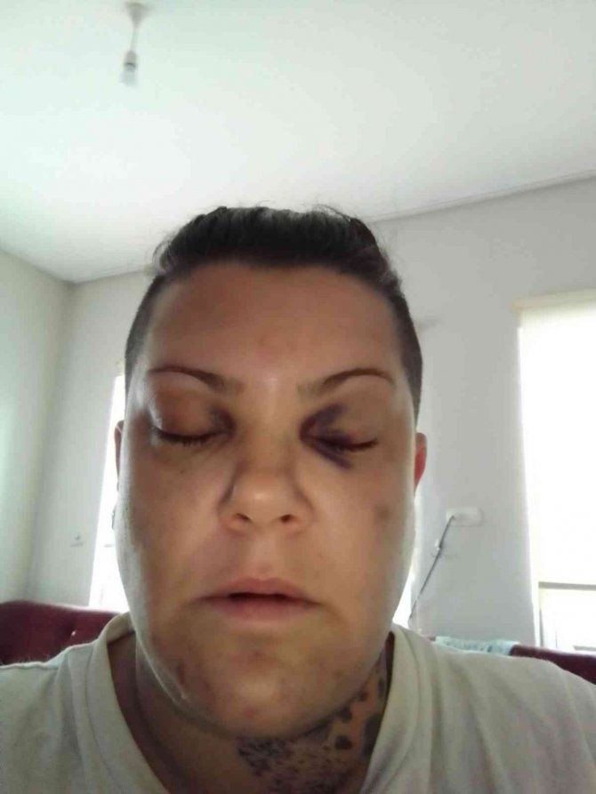 Şarkıcı Mevlanaoğlu, evinin önünde darp edildi