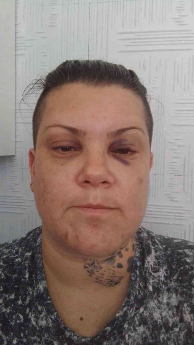 Şarkıcı Mevlanaoğlu, evinin önünde darp edildi