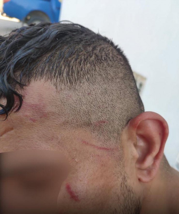 Yunan unsurlarının darbedip, Türk kara sularına ittiği kaçak göçmenler taburcu oldu