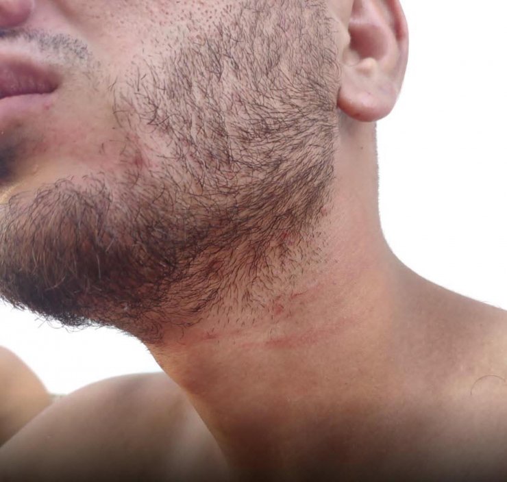 Yunan unsurlarının darbedip, Türk kara sularına ittiği kaçak göçmenler taburcu oldu