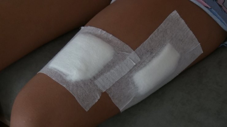 Bacağına yorgun mermi isabet eden Eylül Ece: İnsanların hayatlarıyla oynuyorlar