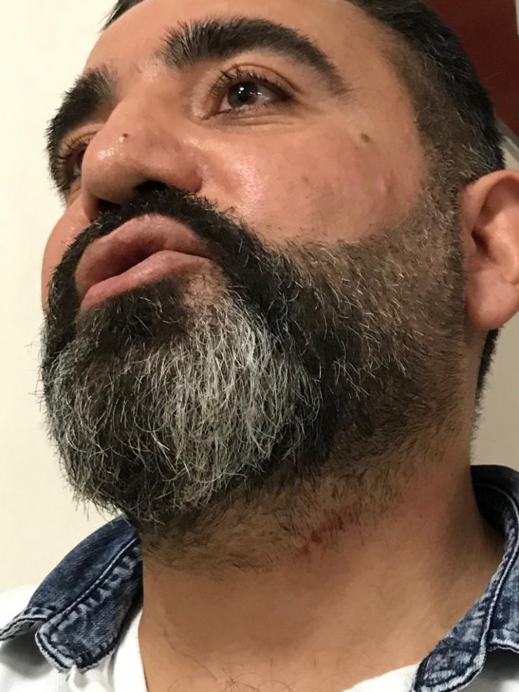 Avukata bıçakla saldırı