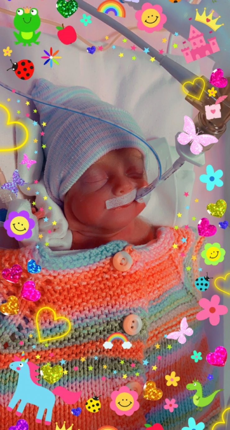 540 gramlık parmak bebek Rabia'yı kök hücre tedavisi hayata bağladı