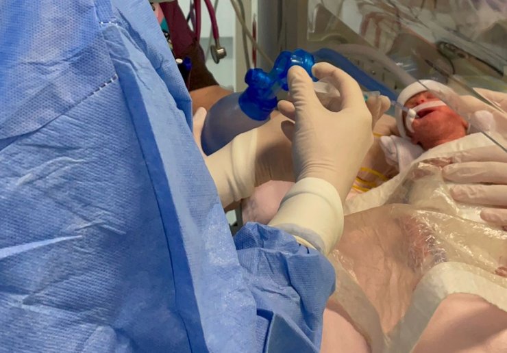 540 gramlık parmak bebek Rabia'yı kök hücre tedavisi hayata bağladı