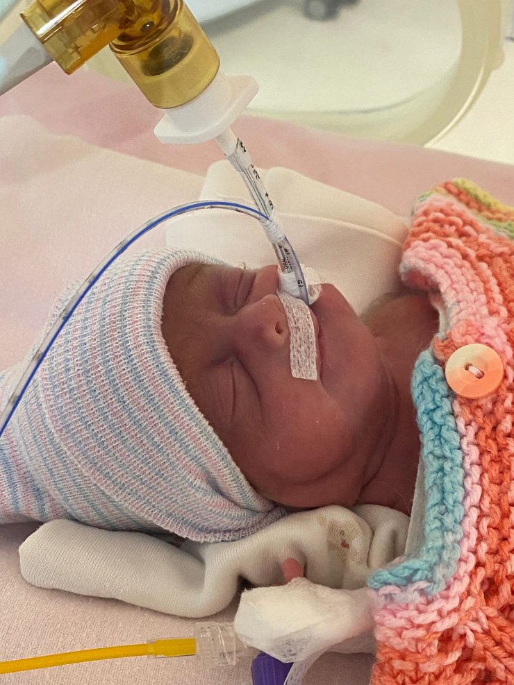 540 gramlık parmak bebek Rabia'yı kök hücre tedavisi hayata bağladı