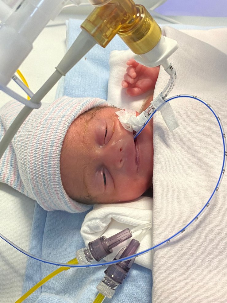 540 gramlık parmak bebek Rabia'yı kök hücre tedavisi hayata bağladı