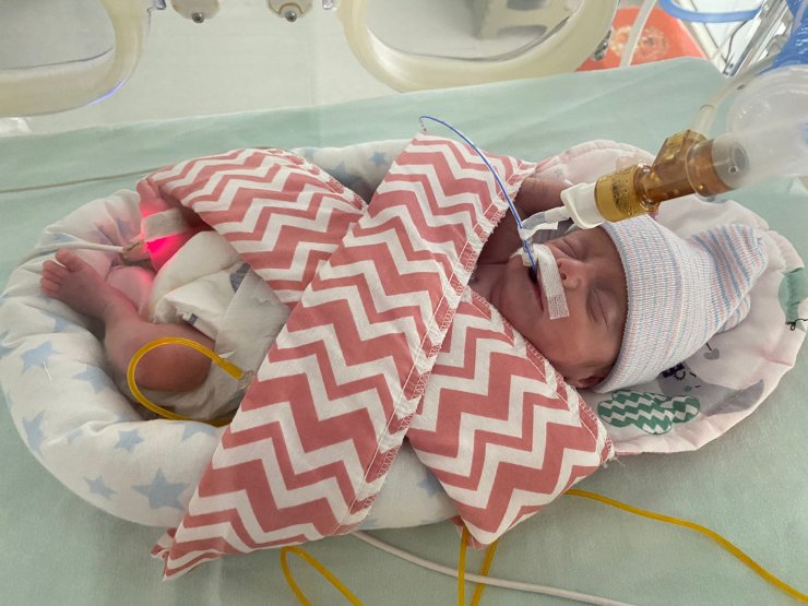 540 gramlık parmak bebek Rabia'yı kök hücre tedavisi hayata bağladı