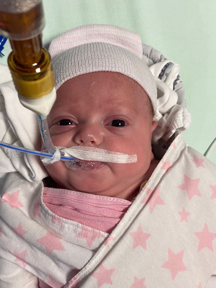 540 gramlık parmak bebek Rabia'yı kök hücre tedavisi hayata bağladı