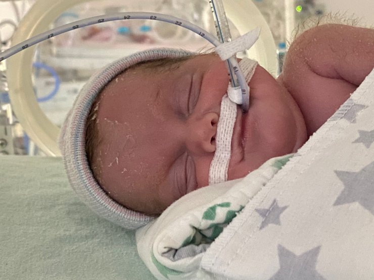 540 gramlık parmak bebek Rabia'yı kök hücre tedavisi hayata bağladı